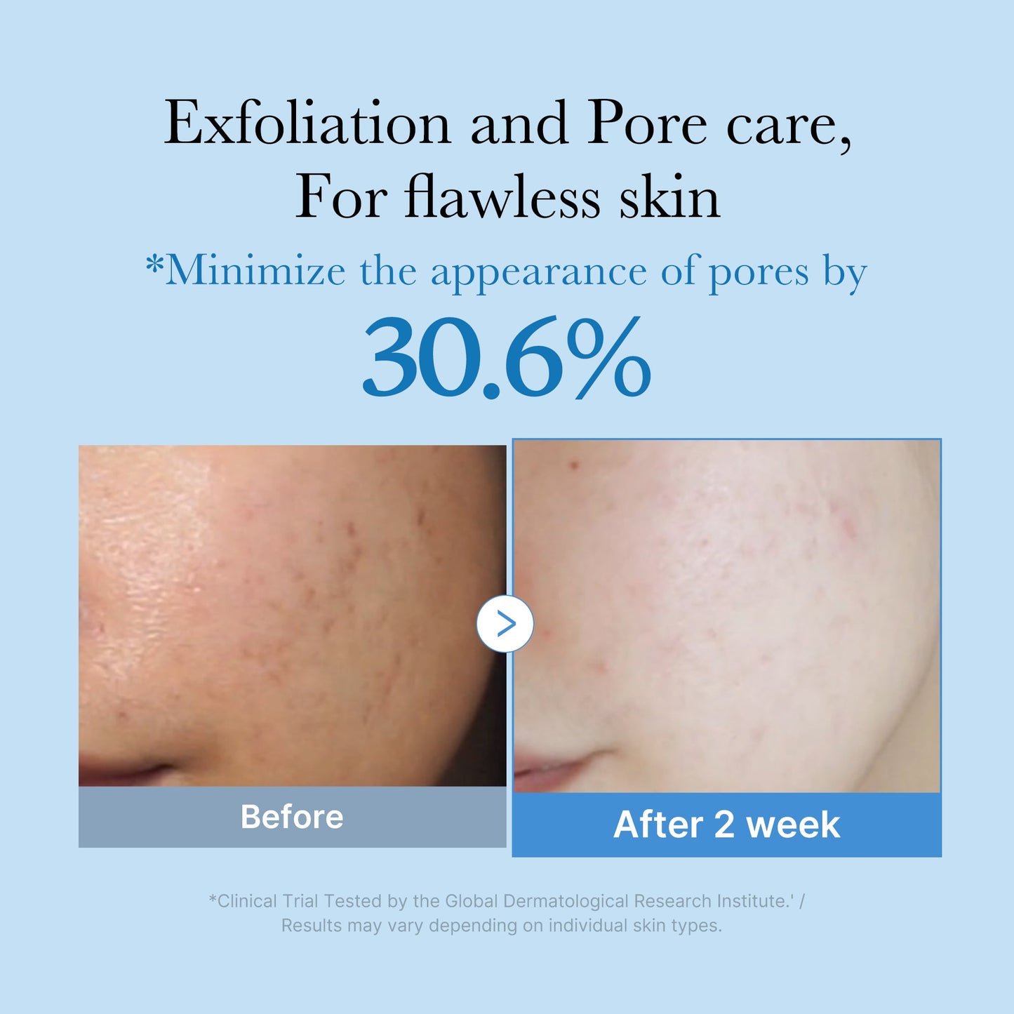 zero-pore-toner-h2 01_d6480b4e-3c08-4954-994a-ed5212c1839c.jpg