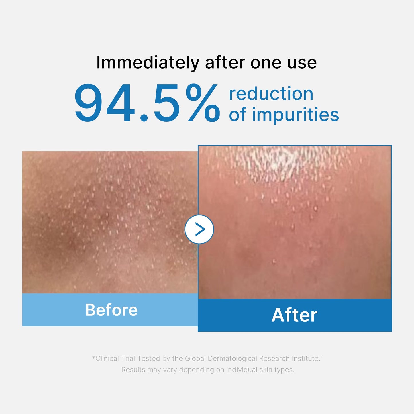 zero-pore-blackhead-deep-cleansing-oil-g2 01_eed557ec-5857-46a2-8b17-dbd67c692dcb.jpg