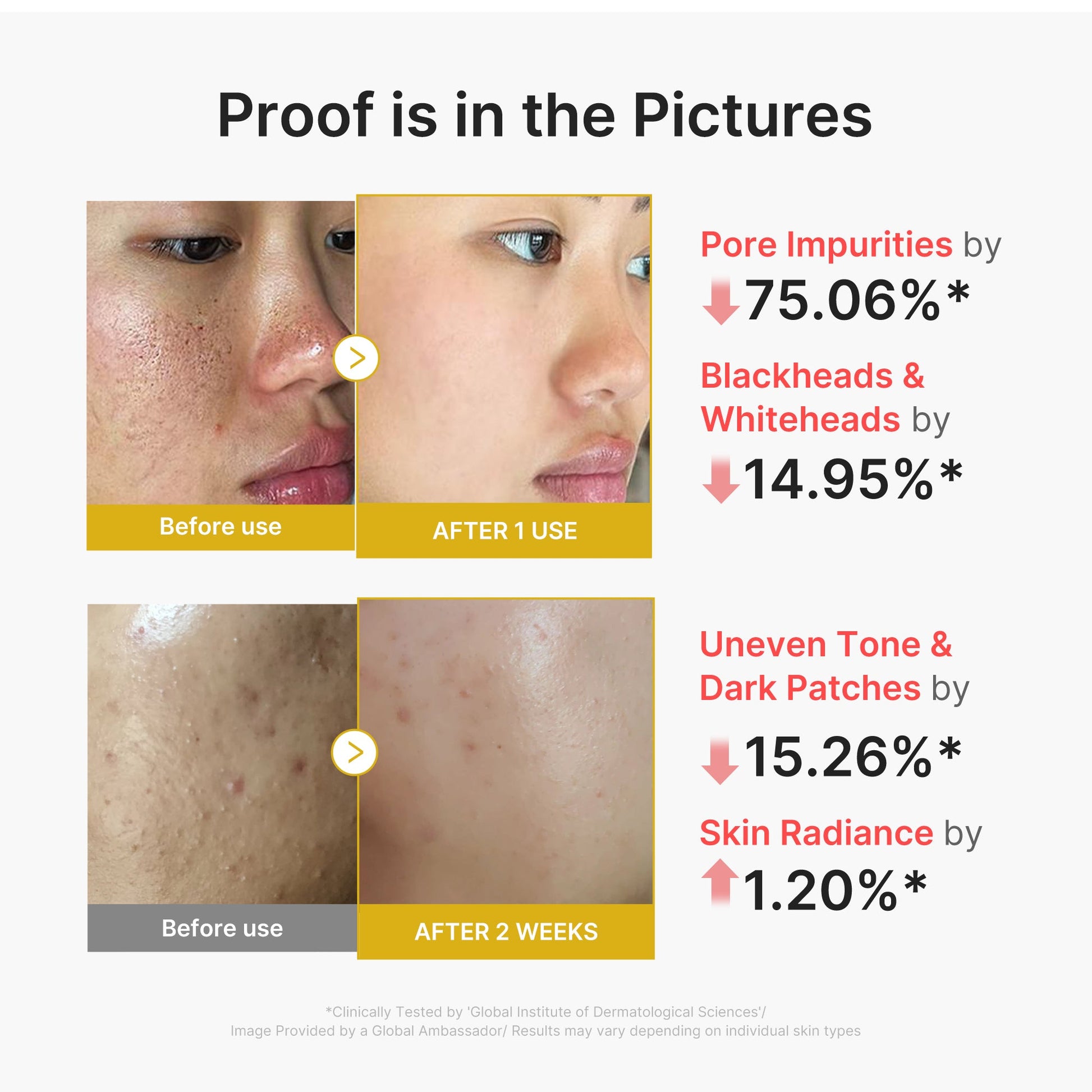 kojic-acid-turmeric-peel-shot-m6 02_45fe66d3-b3f6-4100-aa52-2afd7eded417.jpg