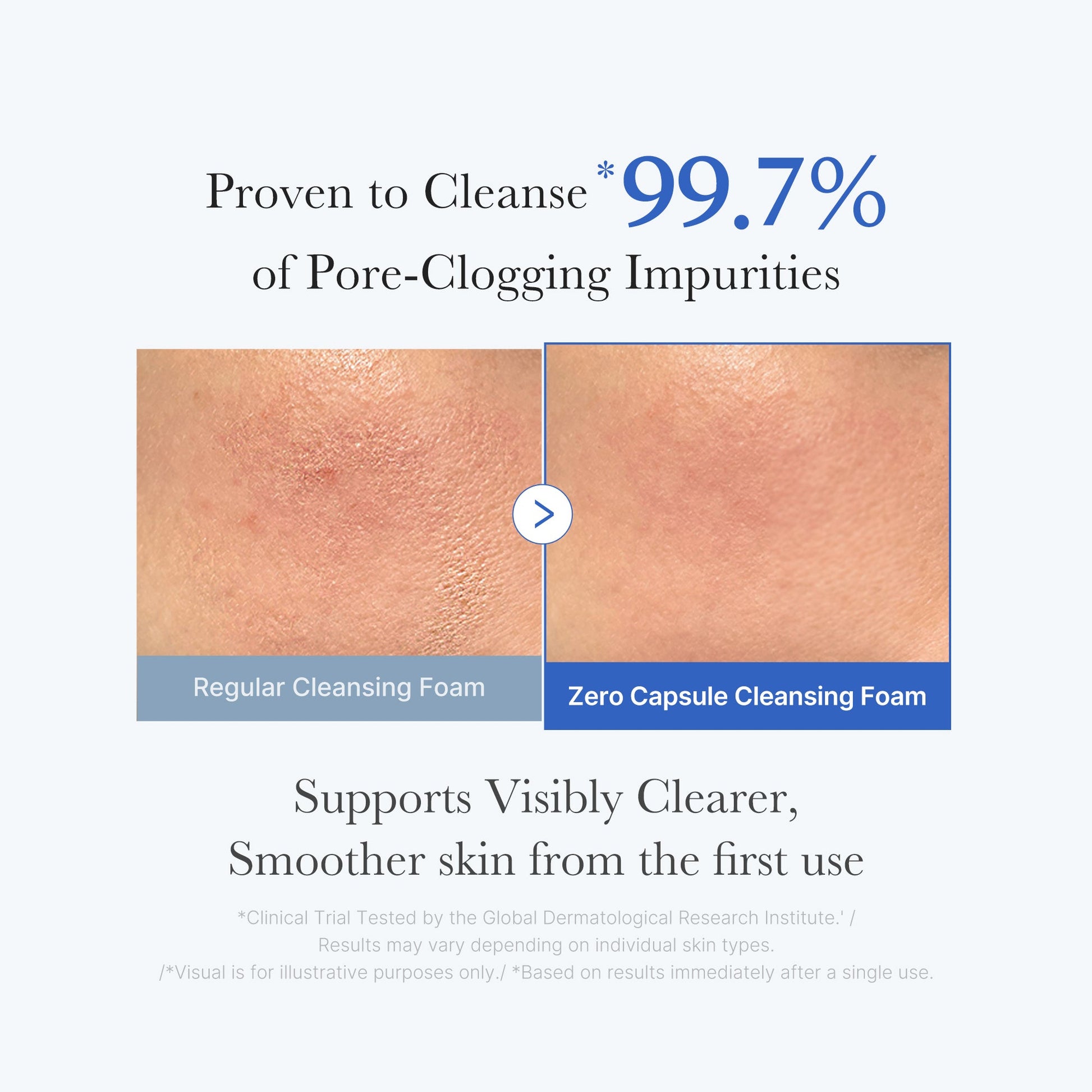 zero-pore-capsule-cleansing-foam-m1 02_c1fb9dfb-86c5-4038-8ff8-490d1006276c.jpg