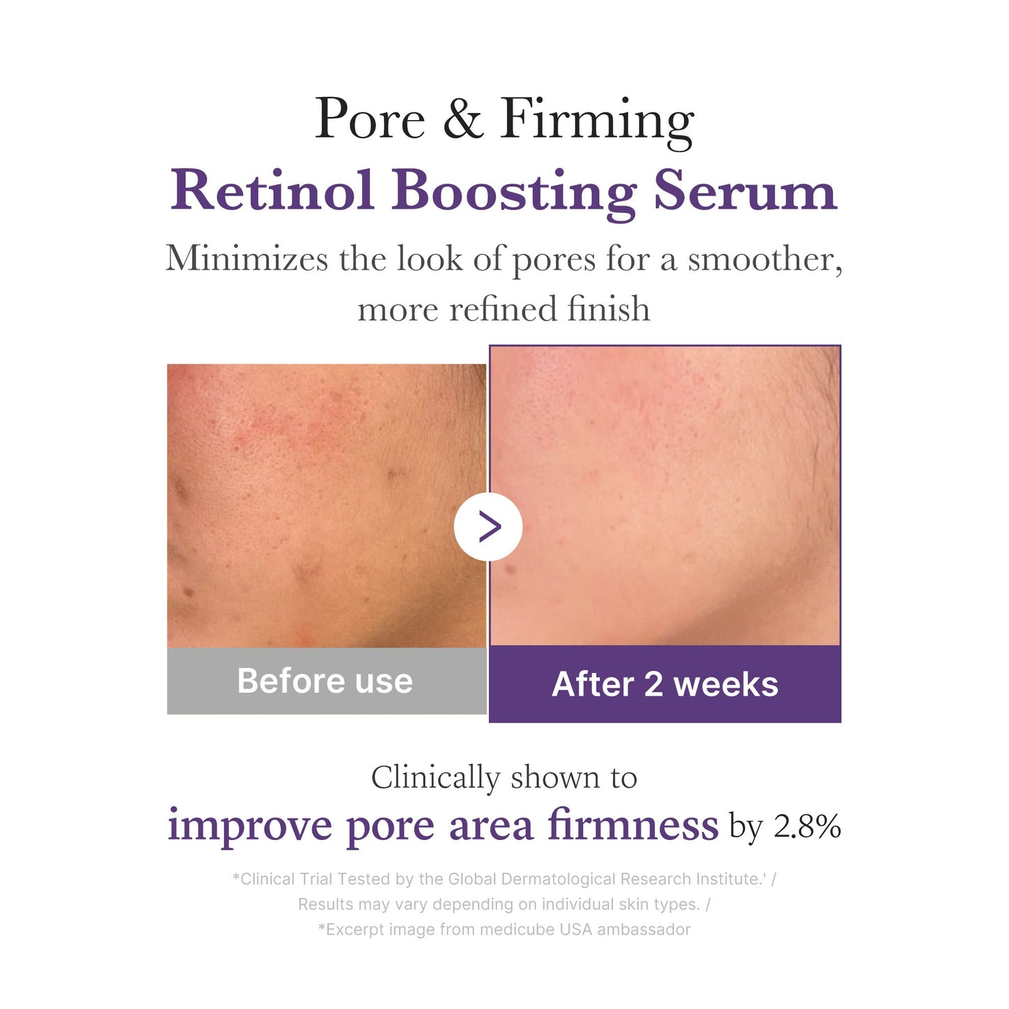 retinol-nmn-boosting-serum-r5 03_3510e7a5-5633-4a18-81ea-1389593bd517.jpg