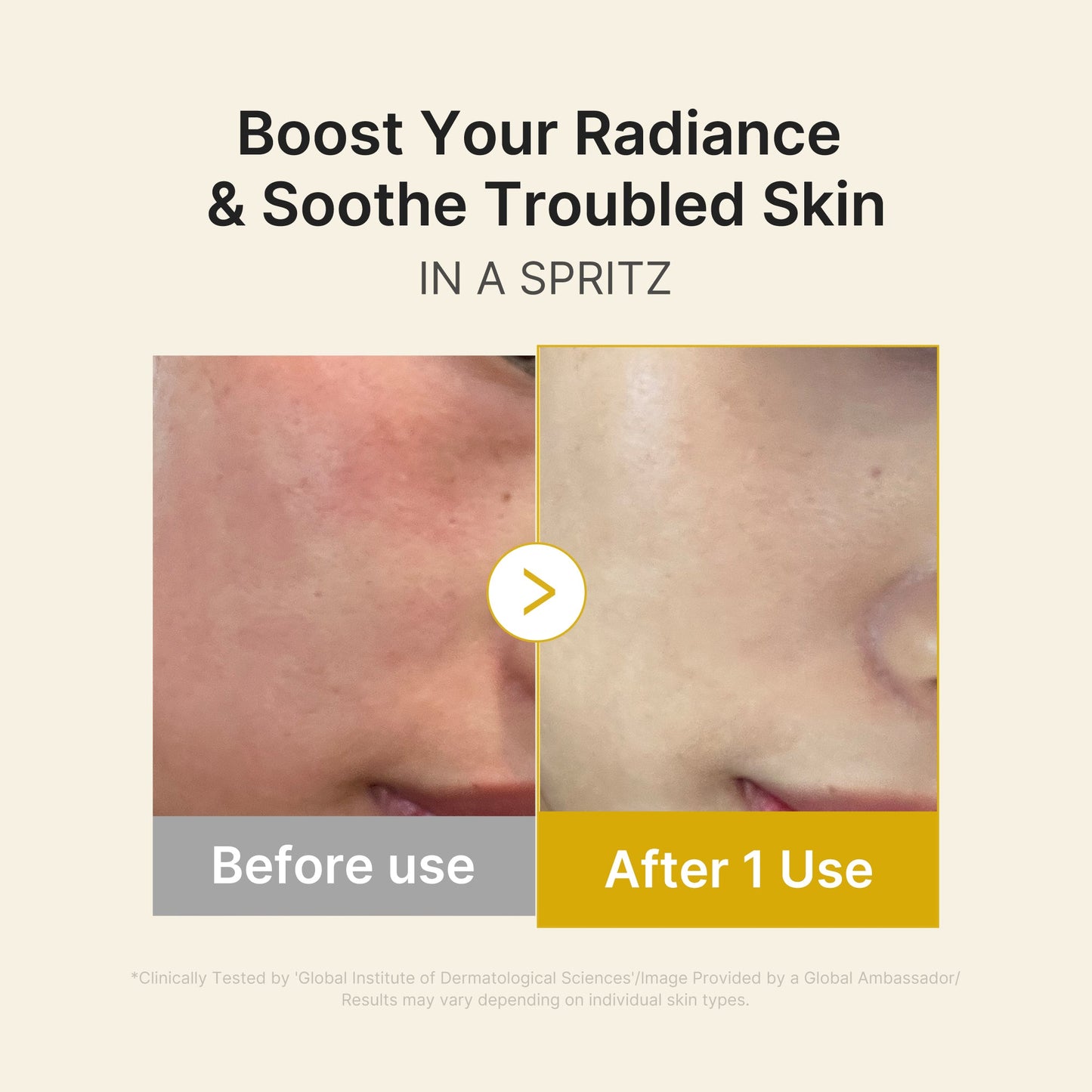 kojic-acid-turmeric-vitamin-gold-jelly-mist-serum-u4 03_dc9cd19e-4e57-49d3-9b66-c7762e8a63f1.jpg