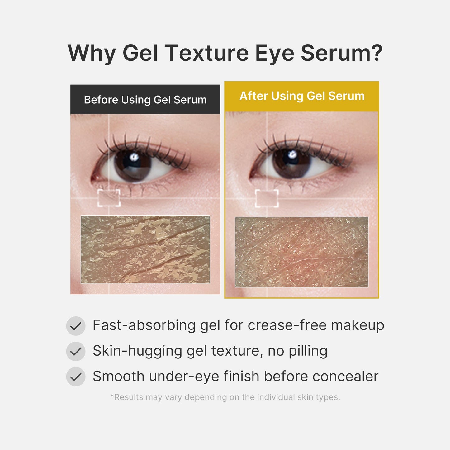 kojic-acid-tumeric-eye-gel-serum-m8 04_0487ef36-49f4-4294-8049-bb55118b05fe.jpg