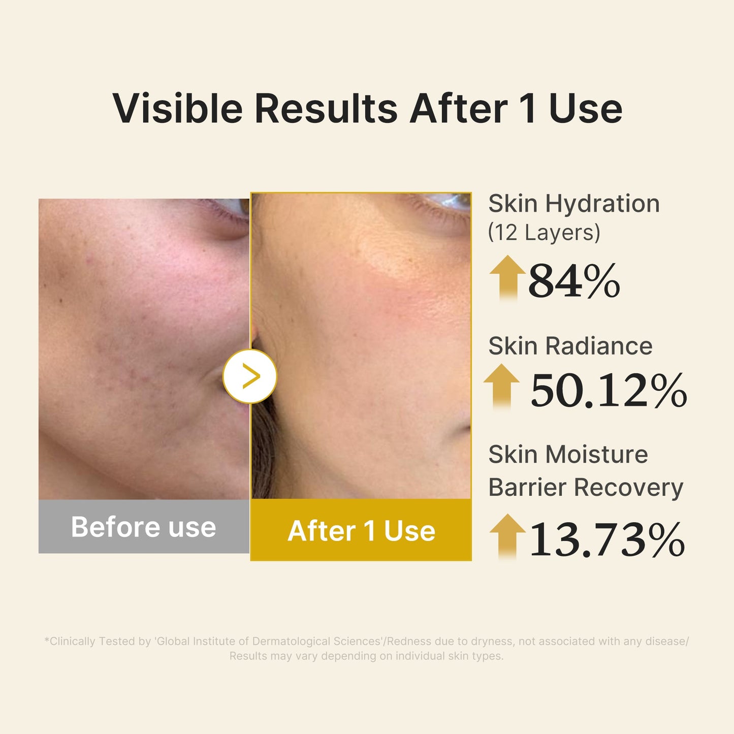 kojic-acid-turmeric-vitamin-gold-jelly-mist-serum-u4 04_d5c55ef1-e03b-494d-bc0d-a1ecc7fc2abf.jpg