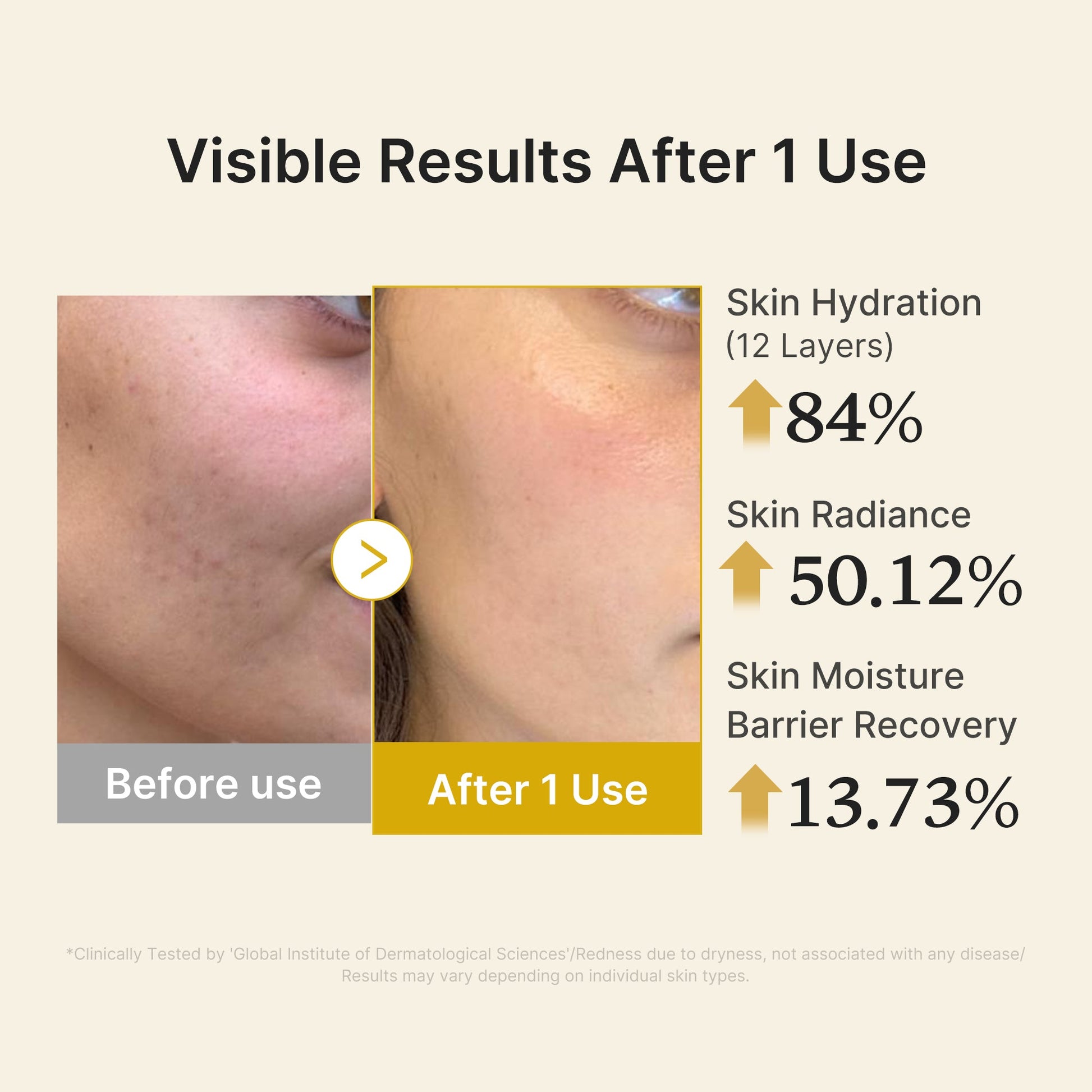 kojic-acid-turmeric-vitamin-gold-jelly-mist-serum-u4 04_d5c55ef1-e03b-494d-bc0d-a1ecc7fc2abf.jpg