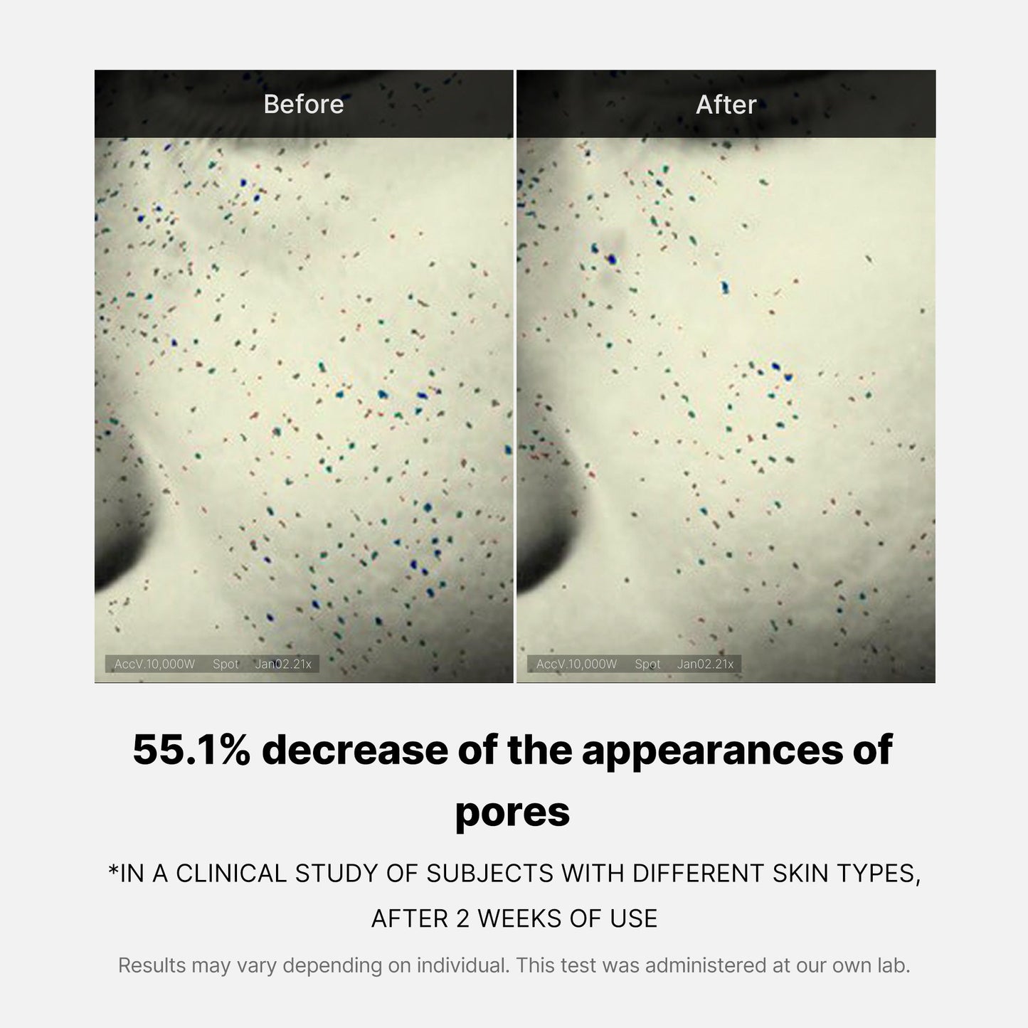 pore-care-duo-t1 05_12ddab8a-64be-4612-8ee1-27e5ec701921.jpg