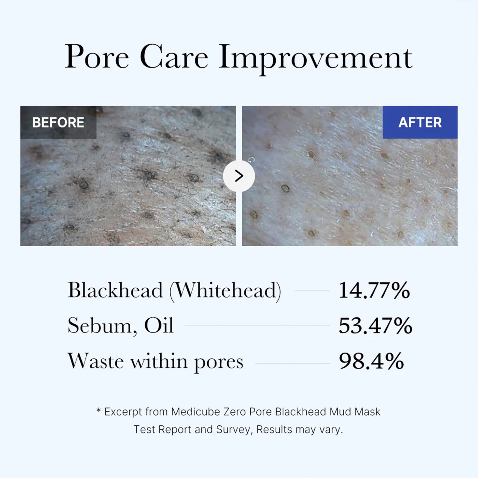 zero-pore-blackhead-mud-mask-a2 05_9362a158-c2b3-4525-acc0-631a2cfdea47.jpg