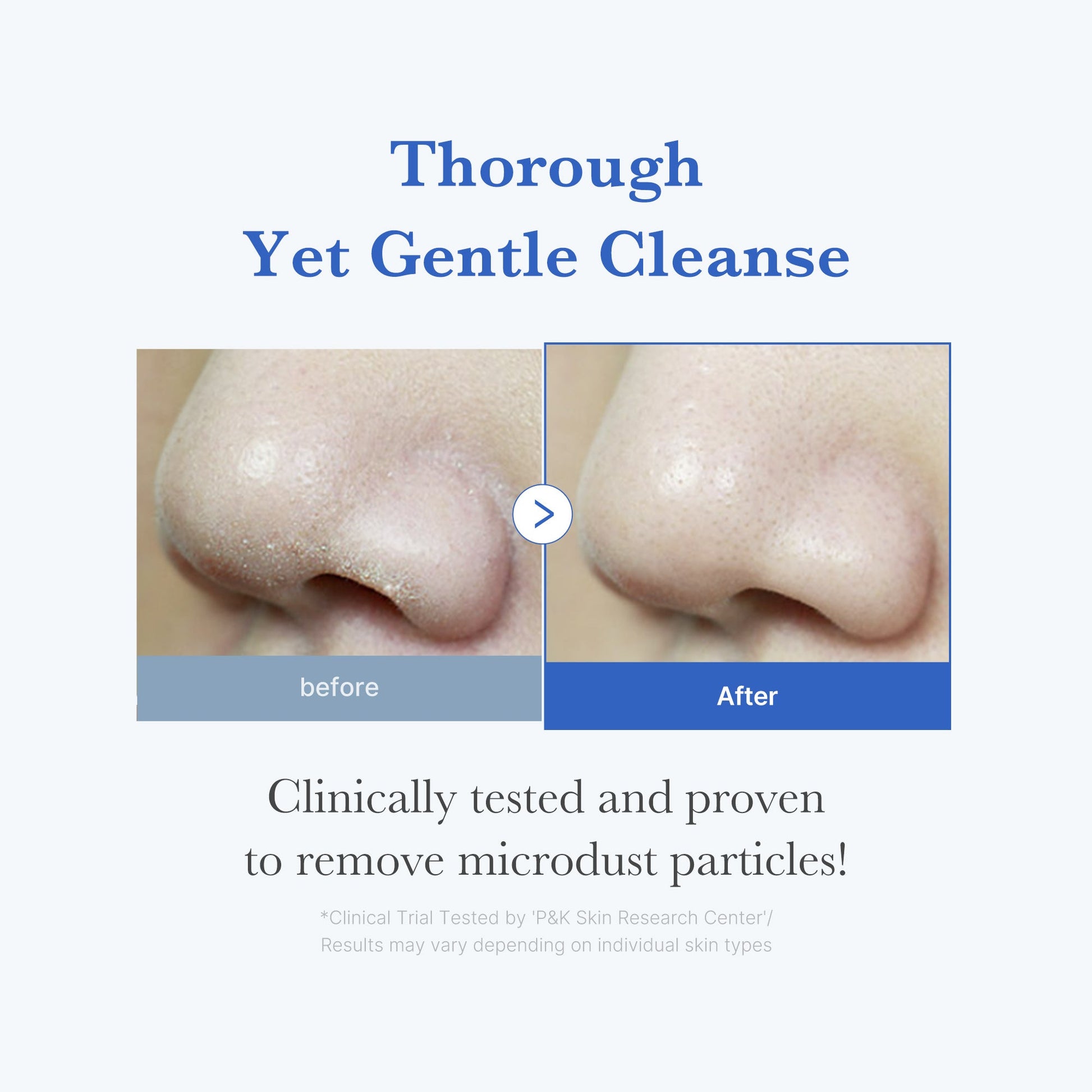 zero-foam-cleanser-i4 250702_ZeroCleanser3.jpg