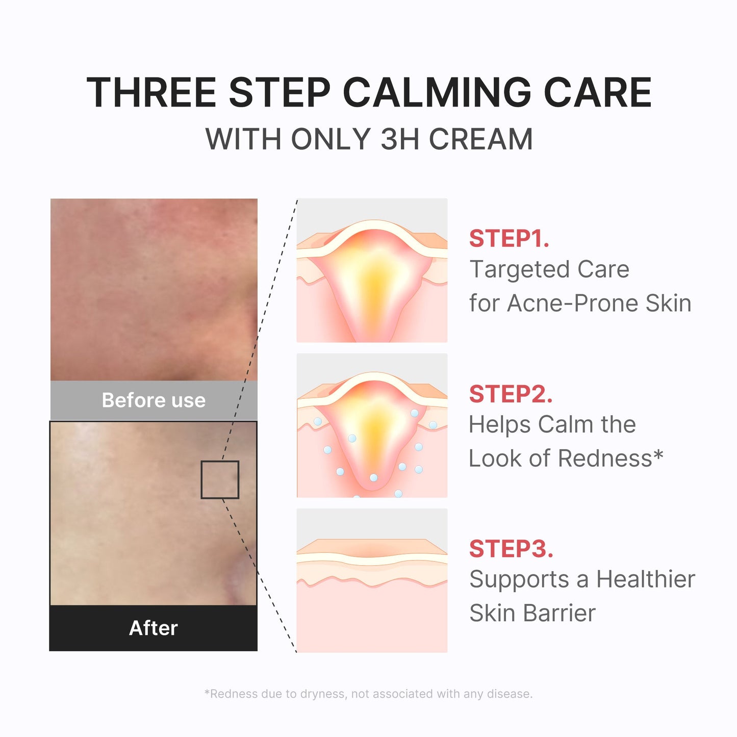 3h-daily-relief-cream-m3 3H_04.jpg