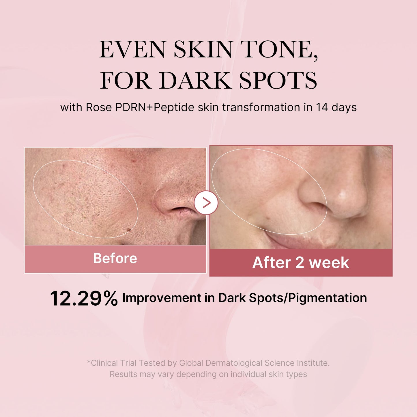 pdrn-pink-peptide-toner-h1 PDRN_01_308c518e-5ac6-4e54-99bd-eabc8796739b.jpg