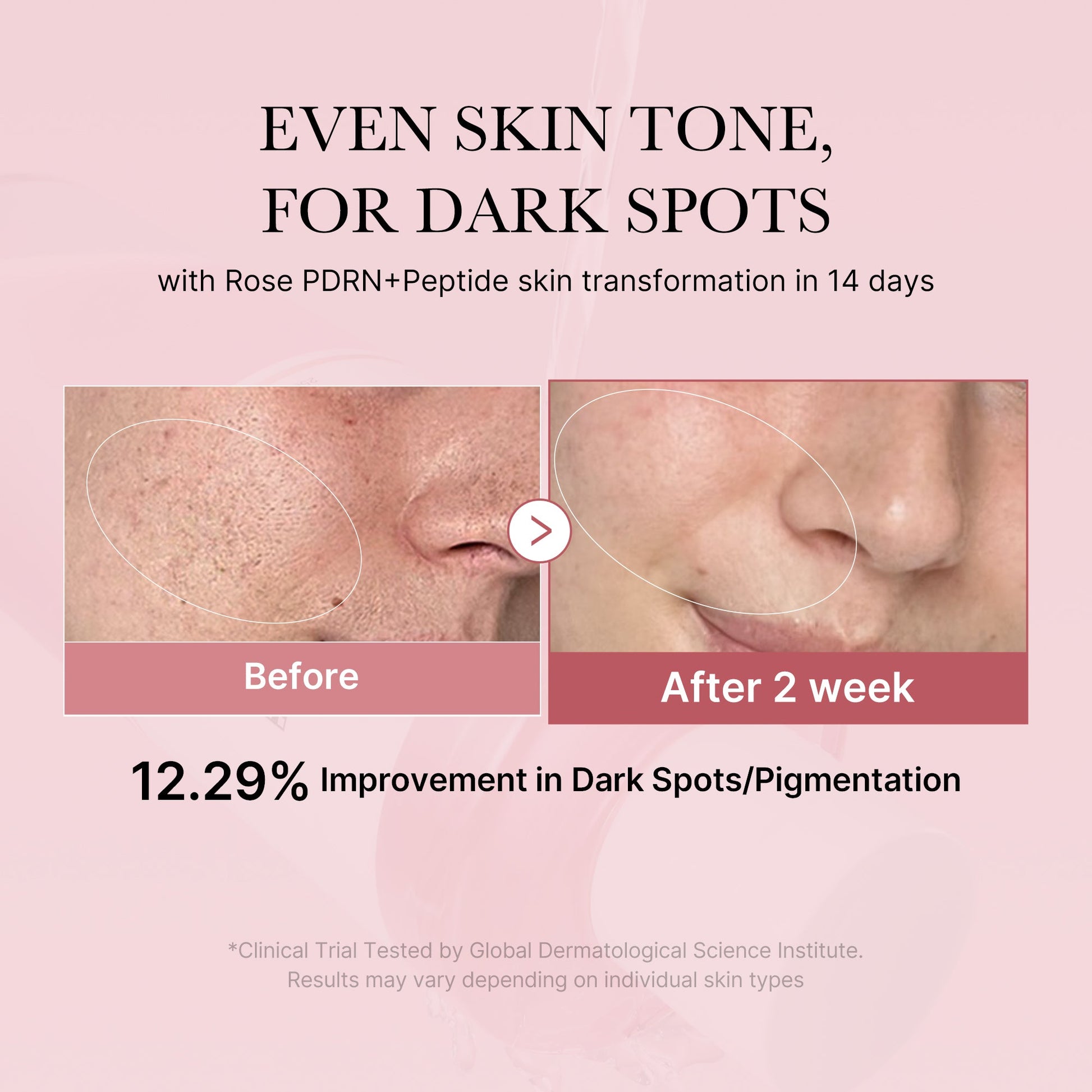 pdrn-pink-peptide-toner-h1 PDRN_01_308c518e-5ac6-4e54-99bd-eabc8796739b.jpg
