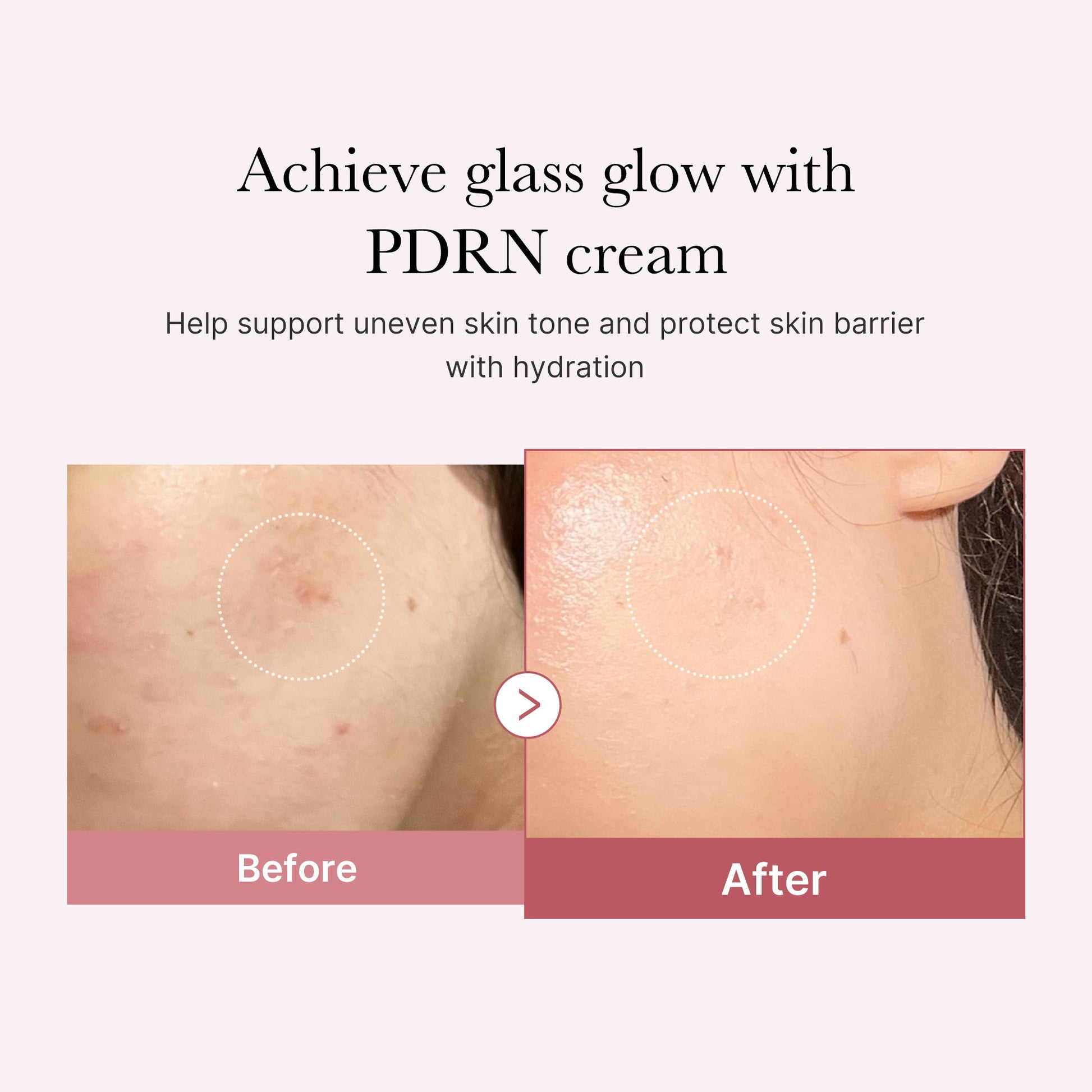 pdrn-pink-peptide-cream-u6 PDRN_02_d7805bfe-cf43-446a-b71b-a276683f136b.jpg