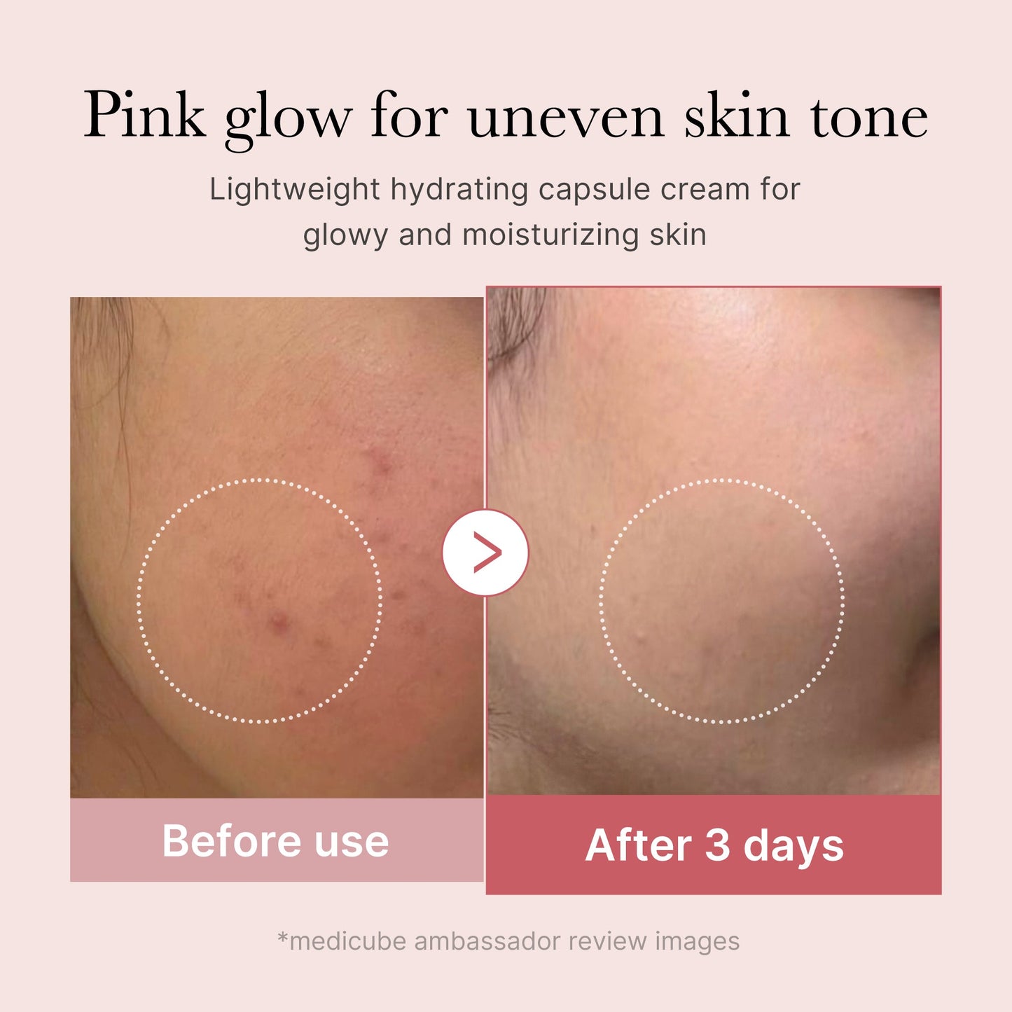 pdrn-pink-collagen-capsule-cream-z5 PDRN_03_058d09d8-4f44-4b1e-927c-e27b1738ae51.jpg