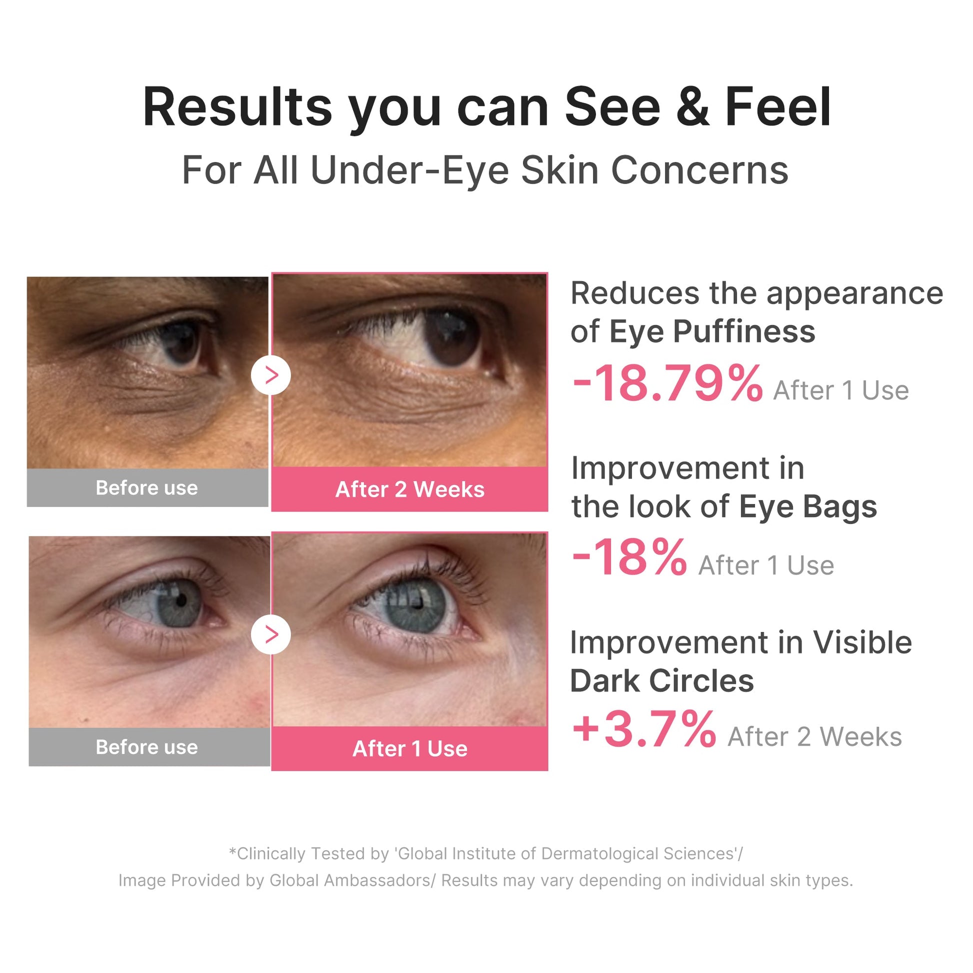 pdrn-caffeine-collagen-eye-patch-e3 PDRN_03_cdce2143-b8d8-43cb-ac69-fcbdf6640249.jpg