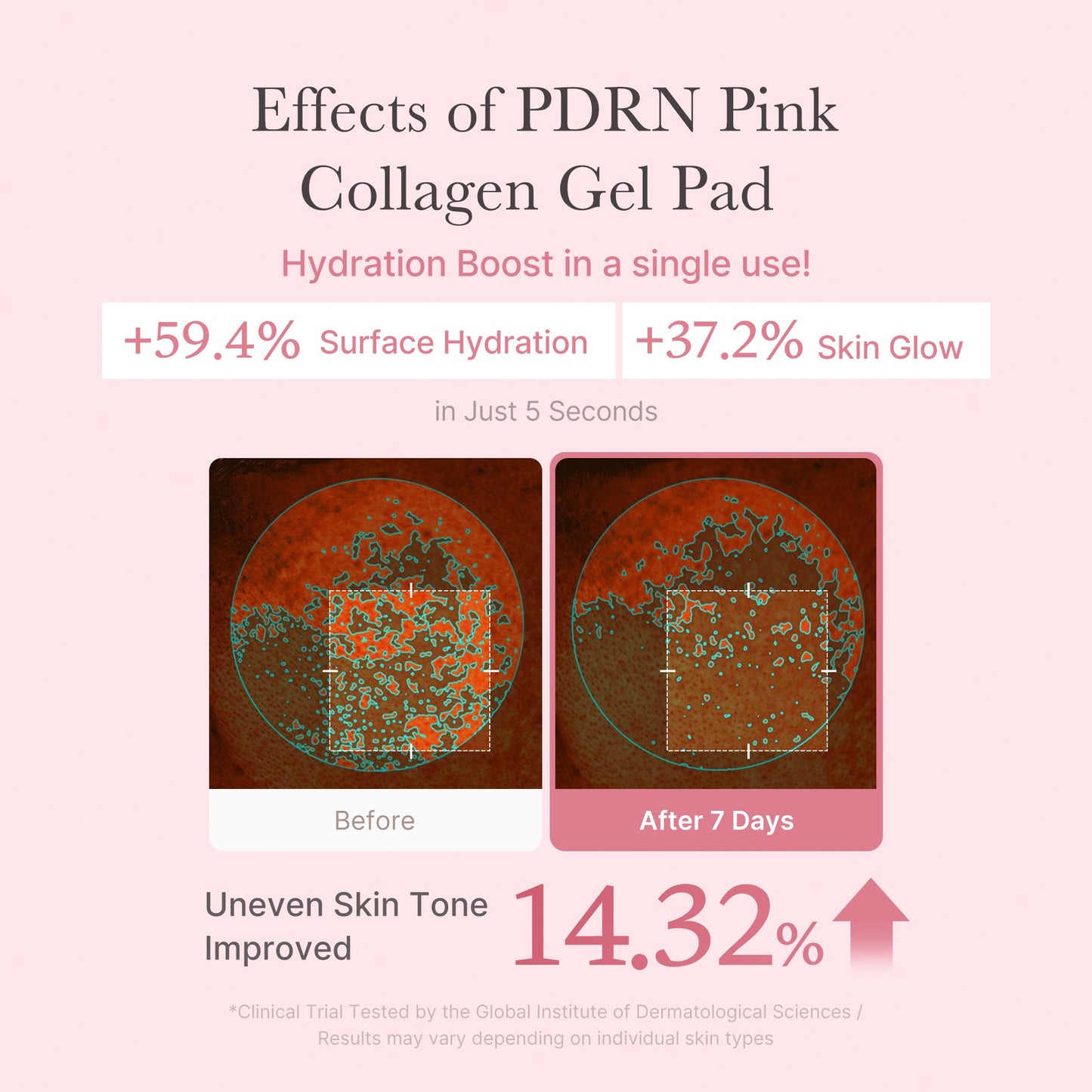 pdrn-pink-collagen-gel-toner-pad-x1 PDRN_04_f9a16a56-8d9e-4c47-a635-ed34ec3ed571.jpg