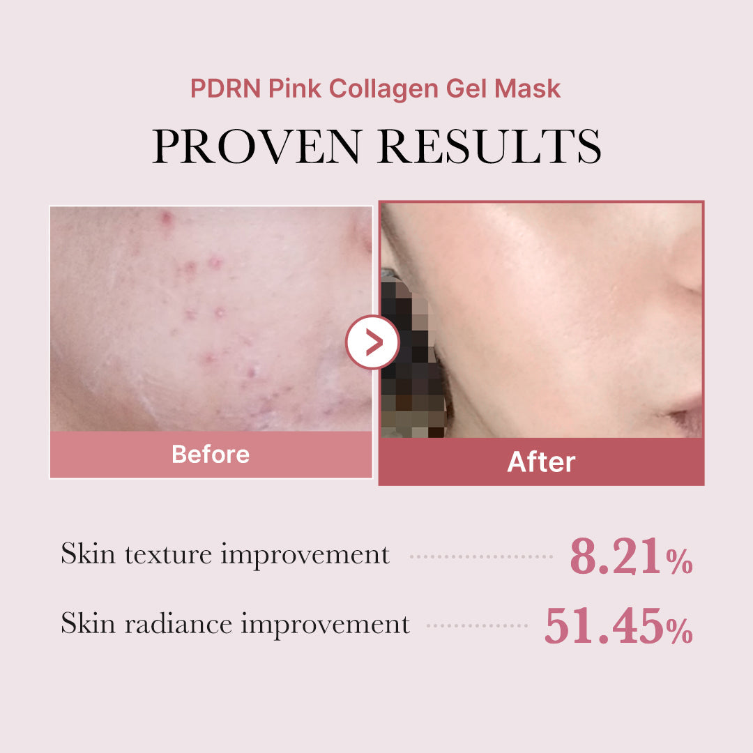 salmon-pdrn-pink-collagen-jelly-gel-mask-o4 PDRN_12.jpg